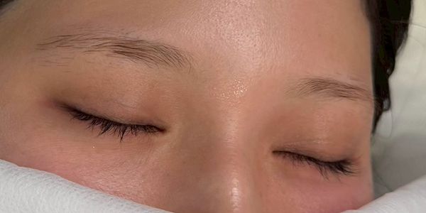 20代女性の眉アートメイクビフォー