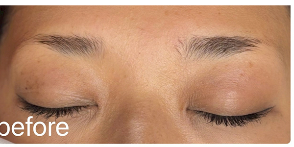 眉アートメイク（毛並み+パウダー技法）30代女性ビフォー