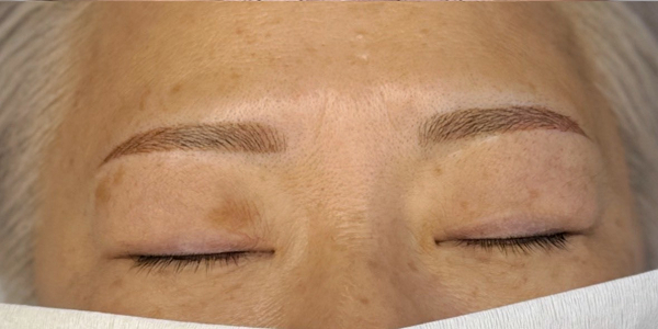 眉毛アートメイク(毛並み＋パウダー技法)【60代・女性】アフター