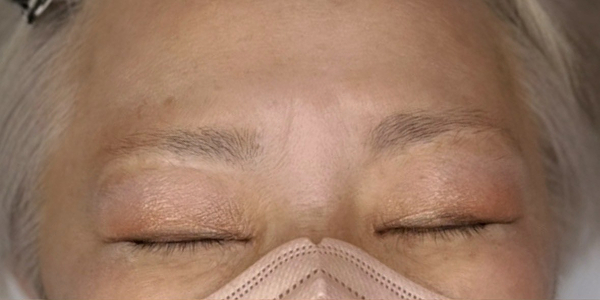 眉毛アートメイク(毛並み＋パウダー技法)【60代・女性】ビフォー