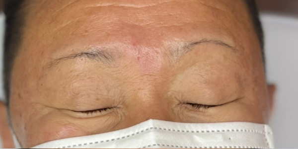 眉毛アートメイク(毛並み＋パウダー技法)【50代・男性】ビフォー