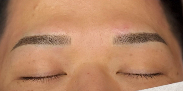 眉毛アートメイク(毛並み＋パウダー技法)【30代・男性】アフター
