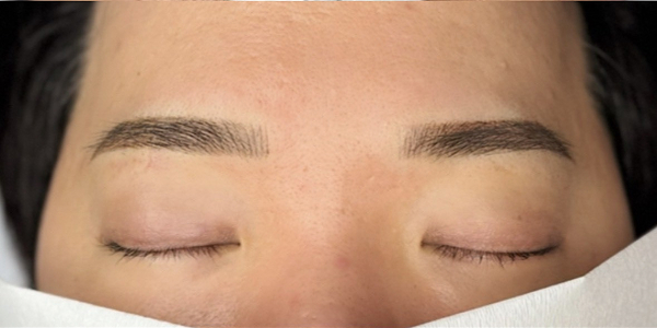 眉毛アートメイク(毛並み＋パウダー技法)【20代・男性】アフター