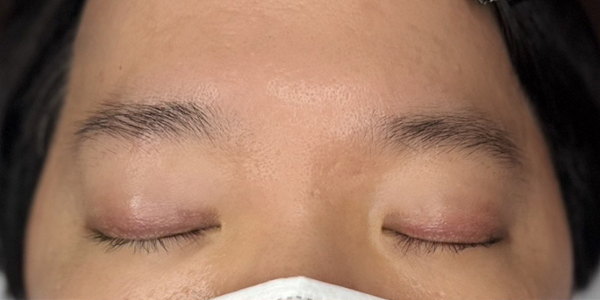 眉毛アートメイク(毛並み＋パウダー技法)【20代・男性】ビフォー