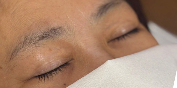 眉アートメイク（毛並み+パウダー）【50代・女性】ビフォー