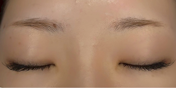 眉アートメイク（毛並み＋パウダー技法）【20代・女性】ビフォー