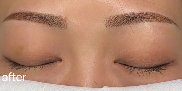 眉アートメイク（毛並み＋パウダー技法）【30代・女性】アフター