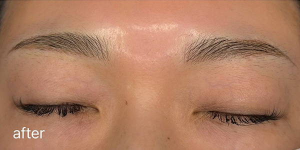 眉アートメイク（毛並み＋パウダー技法）【30代・女性】アフター