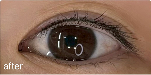 アイラインアートメイクアフター