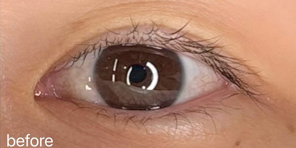アイラインアートメイクビフォー