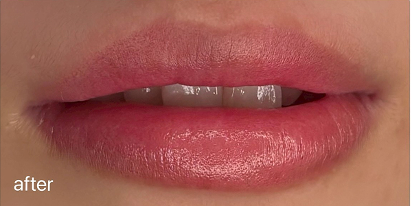 リップアートメイク【20代・女性】アフター
