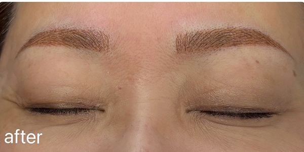 眉アートメイク（毛並み＋パウダー技法）【50代・女性】アフター