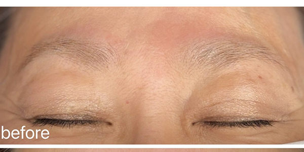 眉アートメイク（毛並み＋パウダー技法）【50代・女性】ビフォー