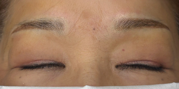 眉アートメイク（毛並み×パウダー）【60代・女性】アフター