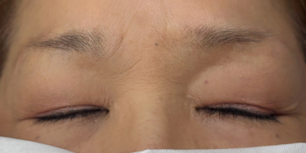 眉アートメイク（毛並み×パウダー）【60代・女性】ビフォー