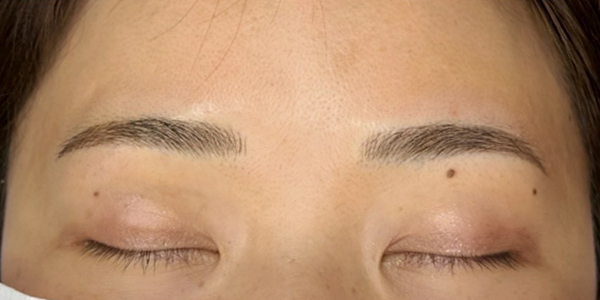眉毛アートメイク(毛並み＋パウダー技法)【30代・女性】アフター