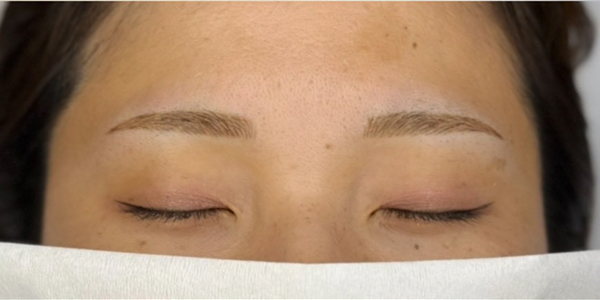 眉毛アートメイク(毛並み＋パウダー技法)【20代・女性】アフター