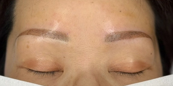 眉毛アートメイク(毛並み＋パウダー技法)【40代・女性】アフター