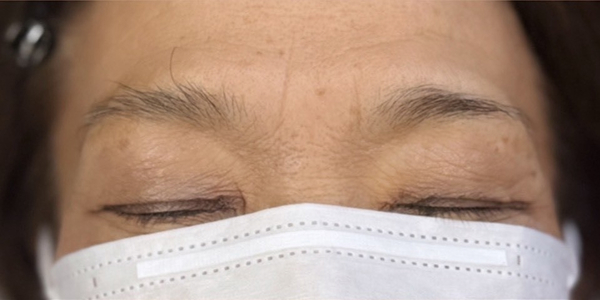 眉毛アートメイク(毛並み＋パウダー技法)【70代・女性】