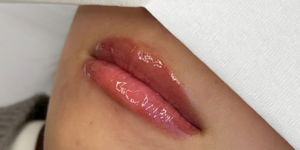 リップアートメイク【30代・女性】アフター