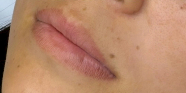 リップアートメイク【30代・女性】ビフォー