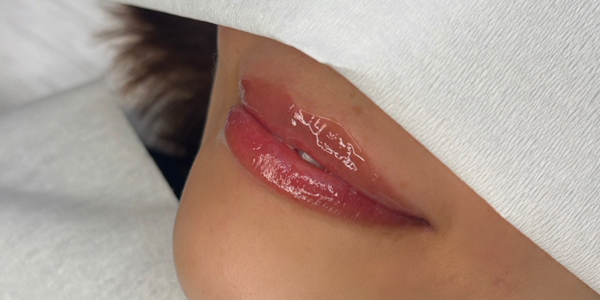 リップアートメイク【40代・女性】アフター