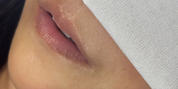 リップアートメイク【40代・女性】ビフォー