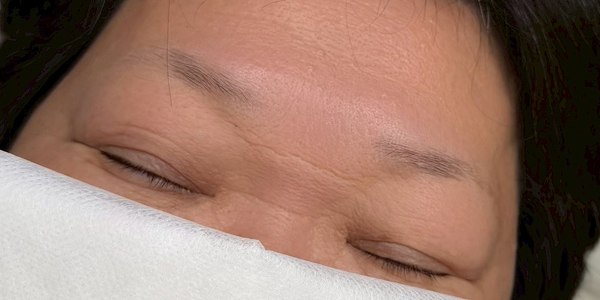 眉アートメイク【70代・女性】ビフォー