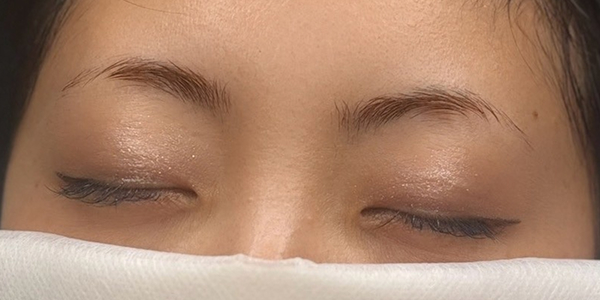 眉アートメイク【30代・女性】ビフォー