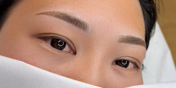 眉アートメイク【20代・女性】アフター