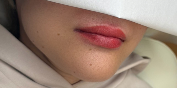 リップアートメイク【50代・女性】アフター