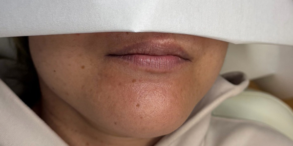 リップアートメイク【50代・女性】アフター