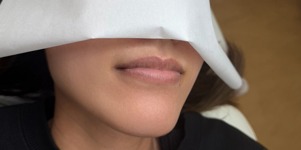 リップアートメイク【30代・女性】ビフォー