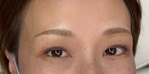 眉アートメイク（ゆるアーチ眉／パウダー）【40代・女性】アフター