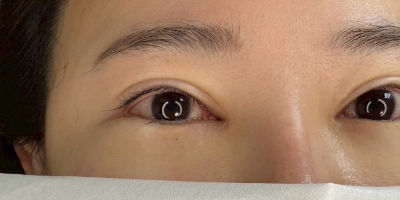 アイラインbefore