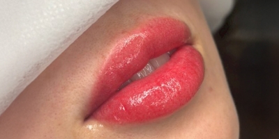 リップアートafter