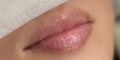 リップアートbefore