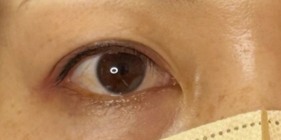 アイラインアートメイクafter