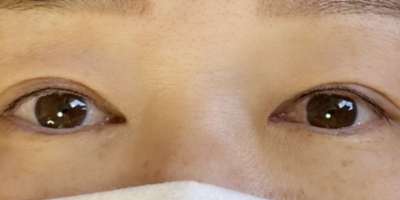 アイラインアートメイクafter