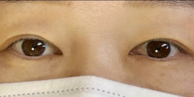 アイラインアートメイクbefore