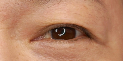 アイラインアートメイクbefore