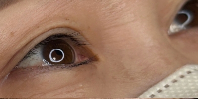 アイラインアートメイクbefore