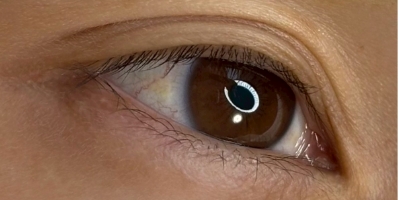 アイラインアートメイクbefore