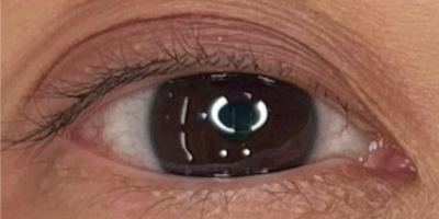 アイラインアートメイクbefore