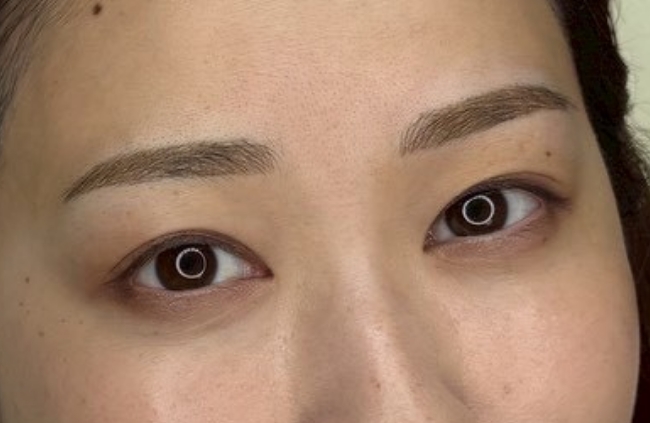 眉頭のみ毛並み＋パウダーafter