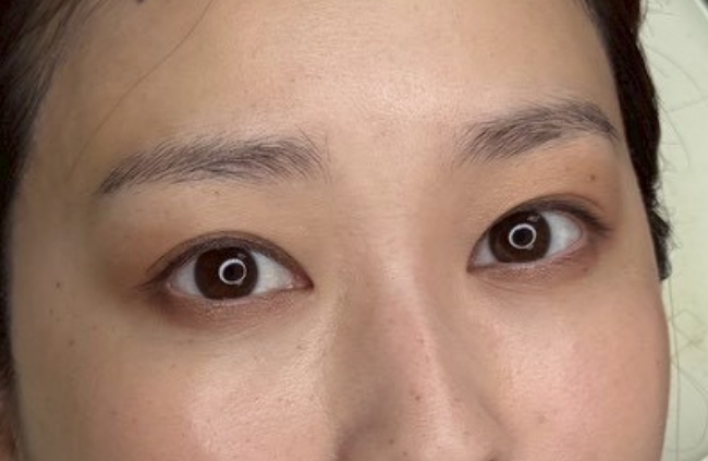 眉頭のみ毛並み＋パウダーbefore